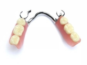 Partial Denture | Smith and Cole Dentistry